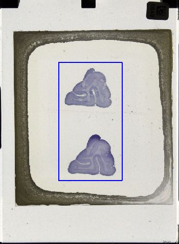 Media type: image; Special Collections 3043   shows specimen_part histological serial section;